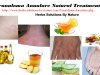 7 Effective Natural Treatments for Granuloma Annulare 