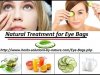 9 Natural Remedies for Eye Bags Best Cure for Puffy Eyes at Your Home
