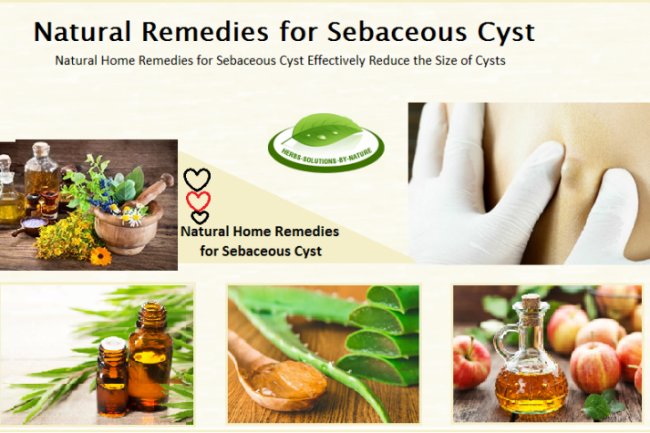 5 Natural Remedies For Sebaceous Cyst Help To Reduce The Size Of Cyst