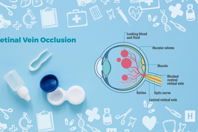 Natural Remedies for Retinal Vein Occlusion with Helpful Ingredients