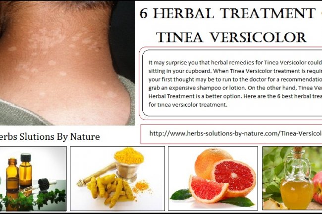Natural Remedies for Tinea Versicolor with Helpful Home Ingredients