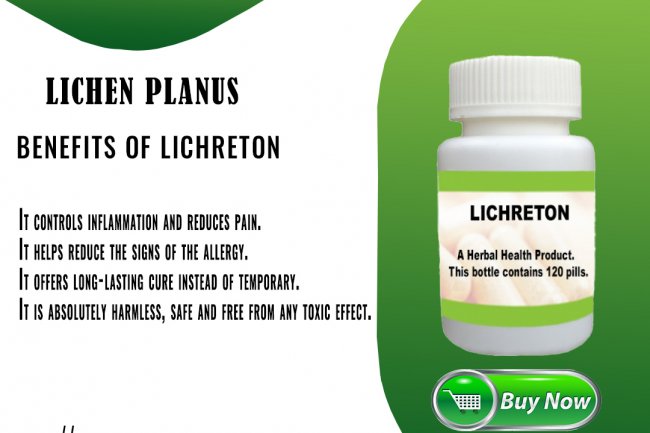 Natural Treatment of Lichen planus and Oral Lichen Planus