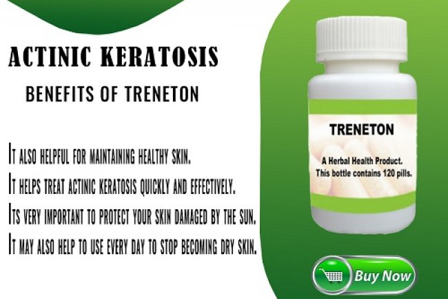 Treneton Actinic Keratosis Cure at Home Naturally