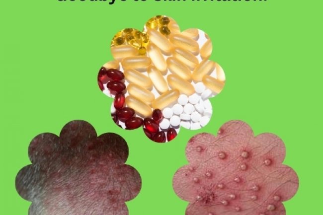 Best Folliculitis Supplements: Say Goodbye to Skin Irritation!