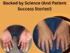 Top 10 Scleroderma Treatments Backed by Science (And Patient Success Stories!)
