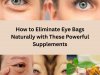 How to Eliminate Eye Bags Naturally with These Powerful Supplements
