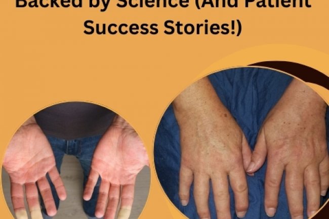 Top 10 Scleroderma Treatments Backed by Science (And Patient Success Stories!)