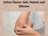 Doctor-Approved Supplements for Lichen Planus—Safe, Natural, and Effective