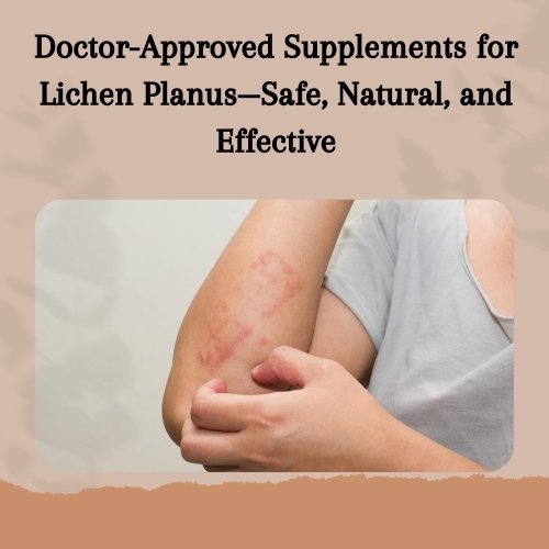 Doctor-Approved Supplements for Lichen Planus—Safe, Natural, and Effective