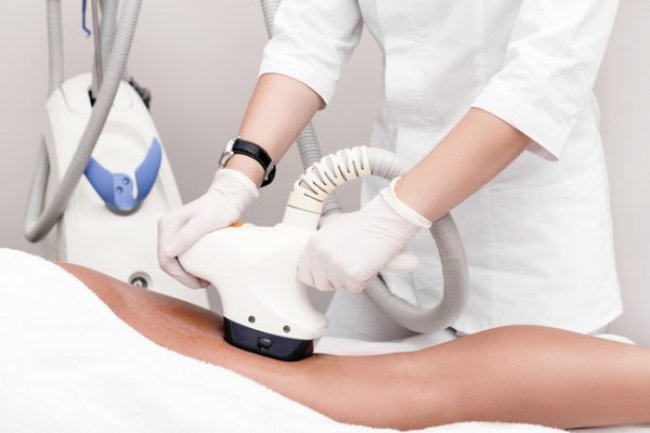 How Long Do Liposonix Results Last? A Long-Term Look