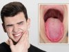 Heal Your Mouth Naturally: The Ultimate Guide to Burning Mouth Syndrome Relief