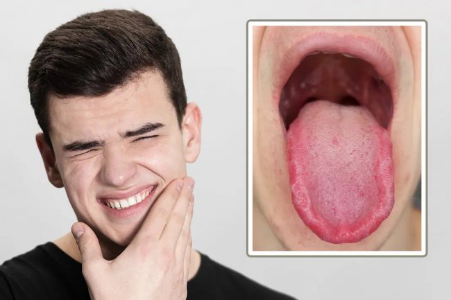 Heal Your Mouth Naturally: The Ultimate Guide to Burning Mouth Syndrome Relief