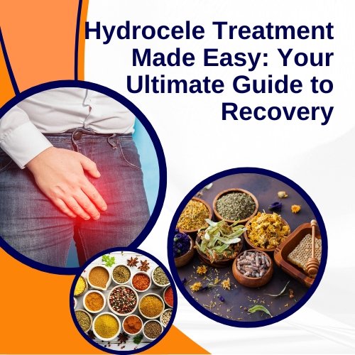 Hydrocele Treatment Made Easy: Your Ultimate Guide to Recovery