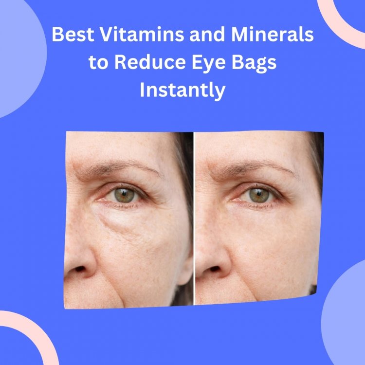 Best Vitamins and Minerals to Reduce Eye Bags Instantly