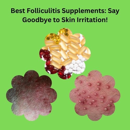 Best Folliculitis Supplements: Say Goodbye to Skin Irritation!